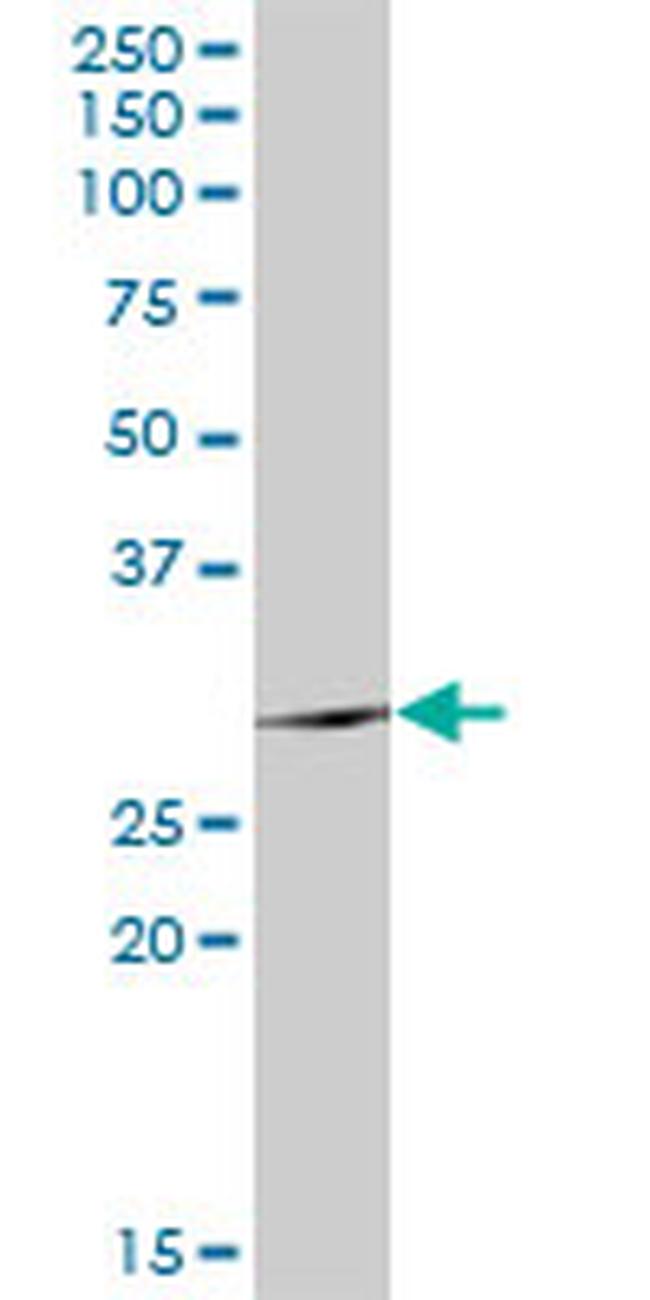 TSSK6 Antibody in Western Blot (WB)