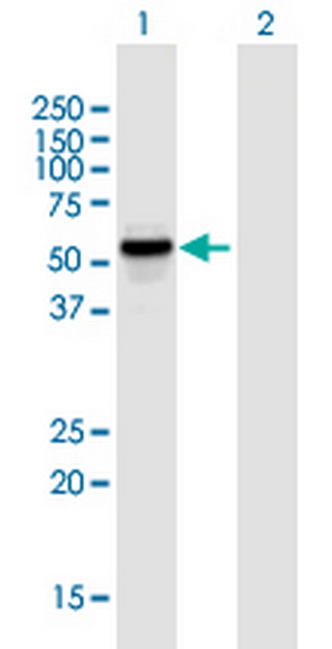 KATNAL1 Antibody in Western Blot (WB)