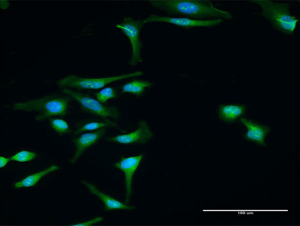 DTNBP1 Antibody in Immunocytochemistry (ICC/IF)