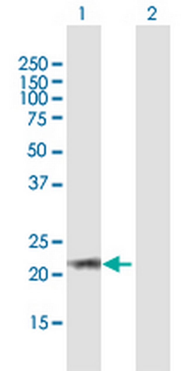 ARL6 Antibody in Western Blot (WB)