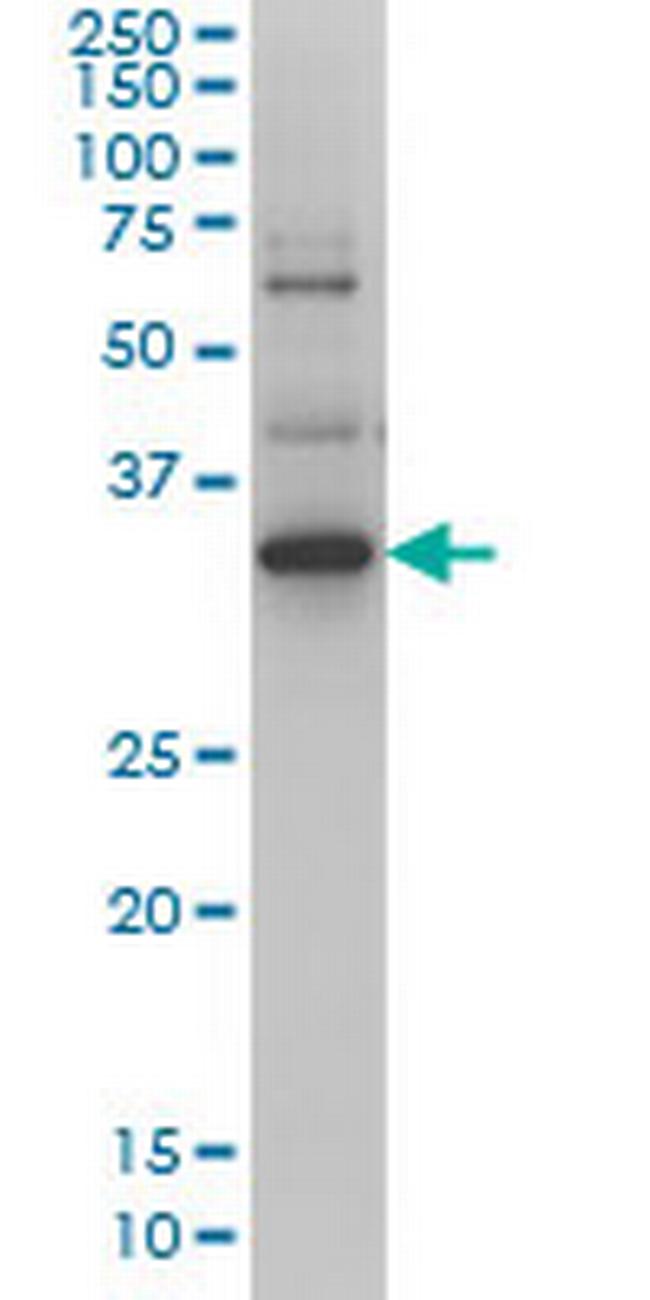 ZIC4 Antibody in Western Blot (WB)