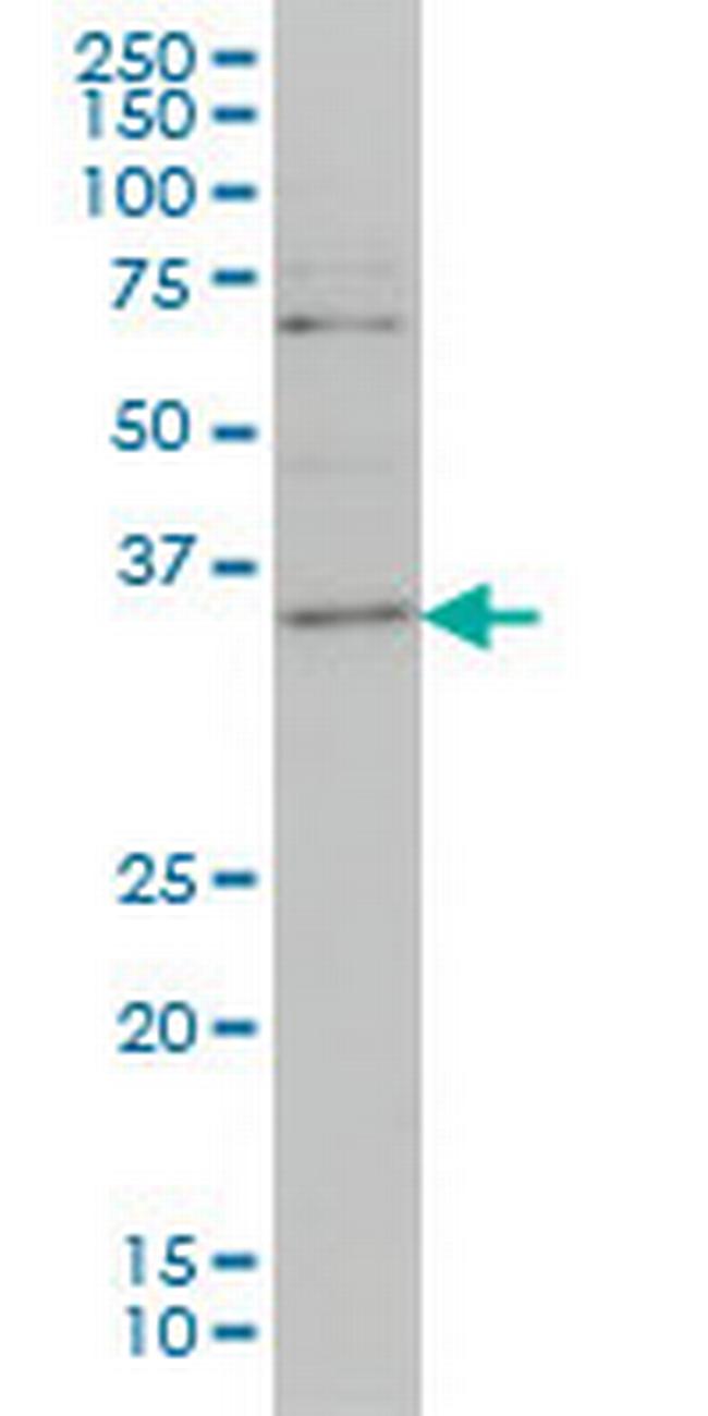 ZIC4 Antibody in Western Blot (WB)