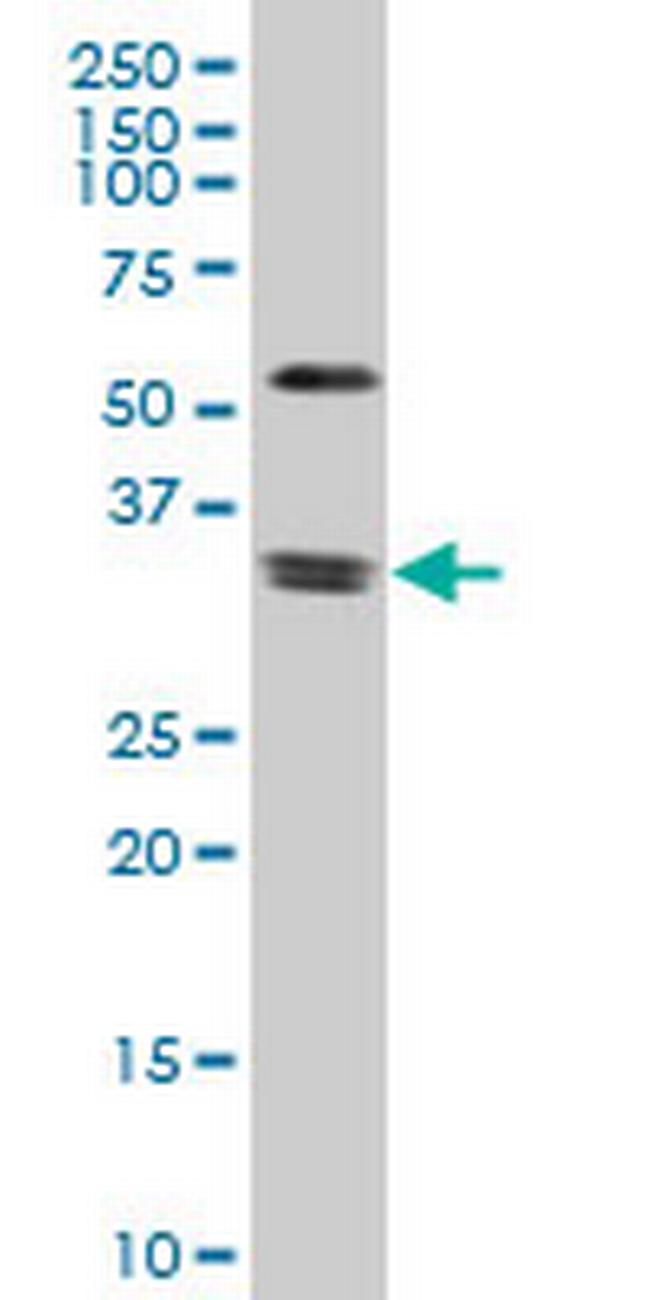 ZIC4 Antibody in Western Blot (WB)