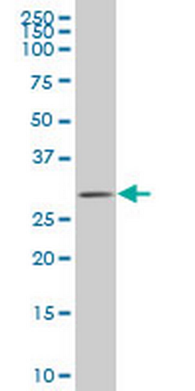 ZIC4 Antibody in Western Blot (WB)