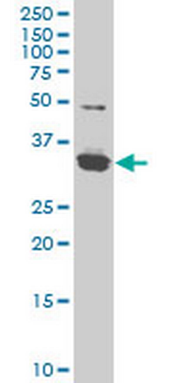 ZIC4 Antibody in Western Blot (WB)