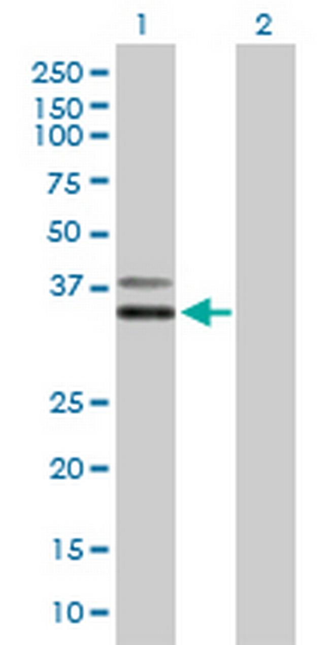 PCGF6 Antibody in Western Blot (WB)