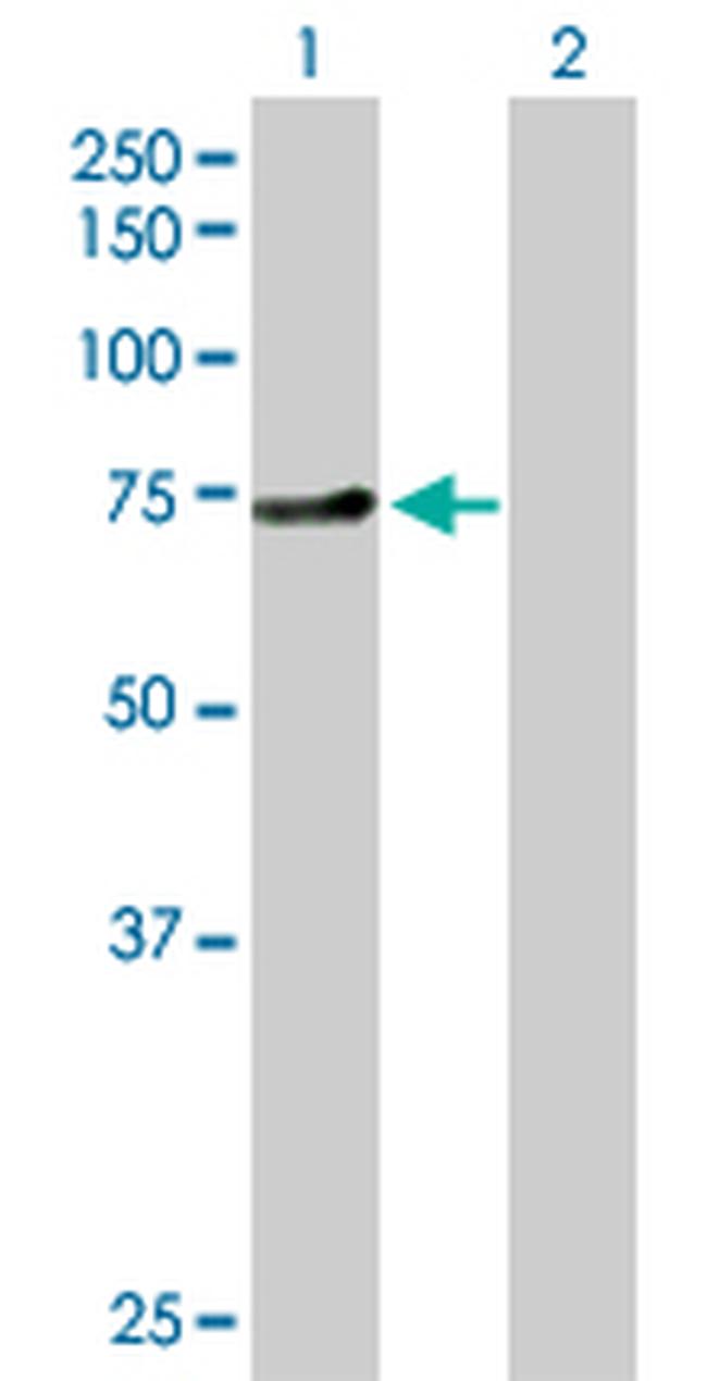 ZNF394 Antibody in Western Blot (WB)