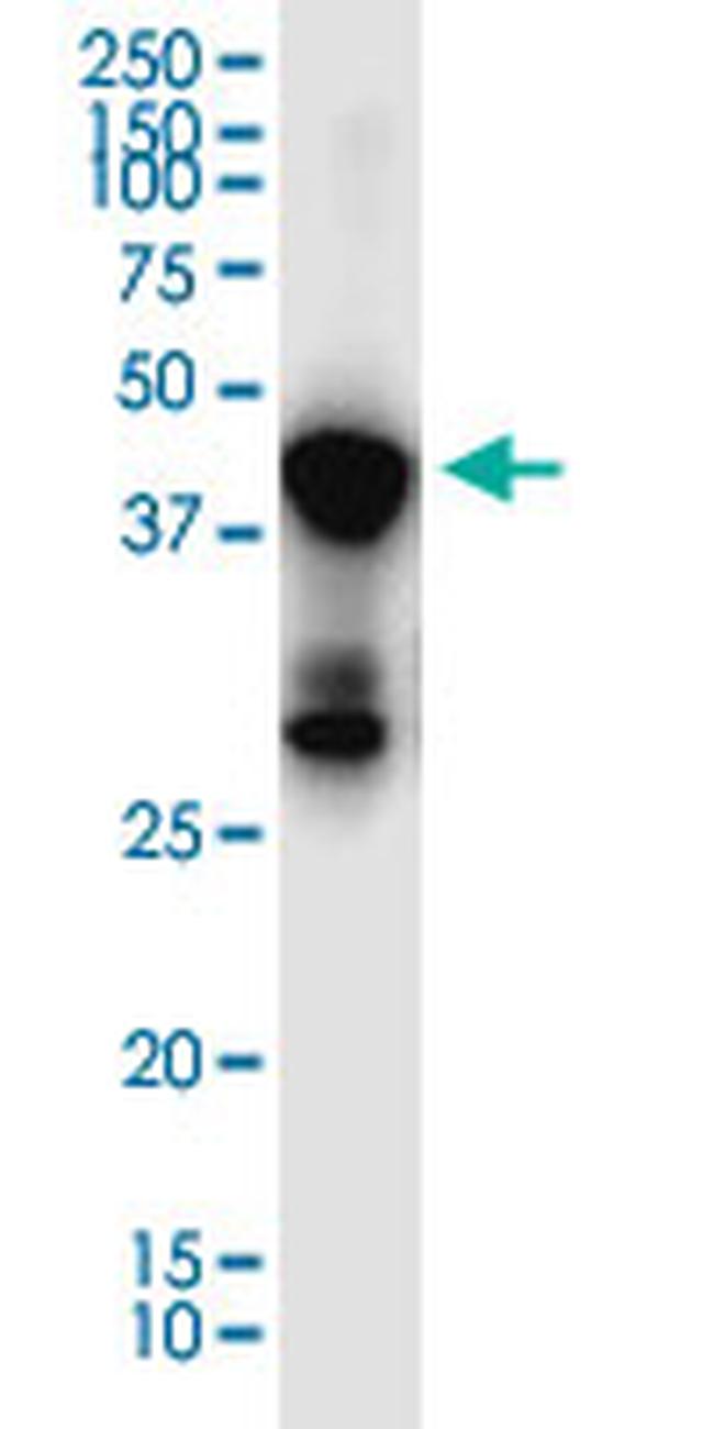 SLC7A6OS Antibody in Western Blot (WB)