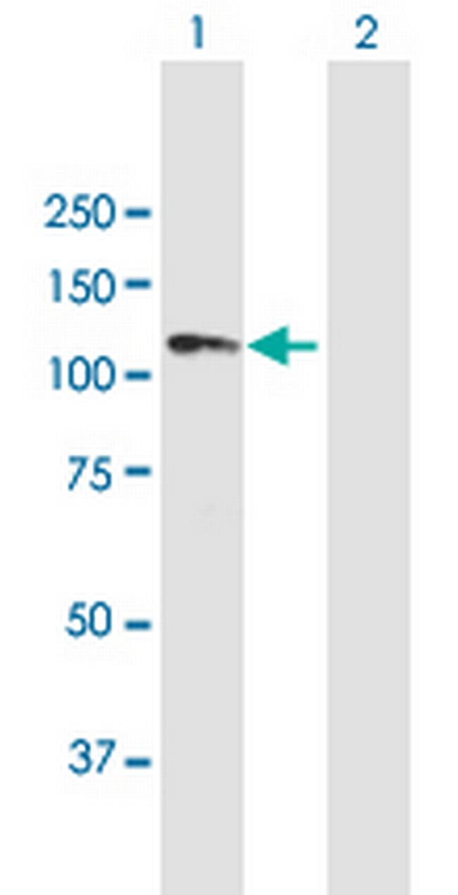 ANKRD20A1 Antibody in Western Blot (WB)