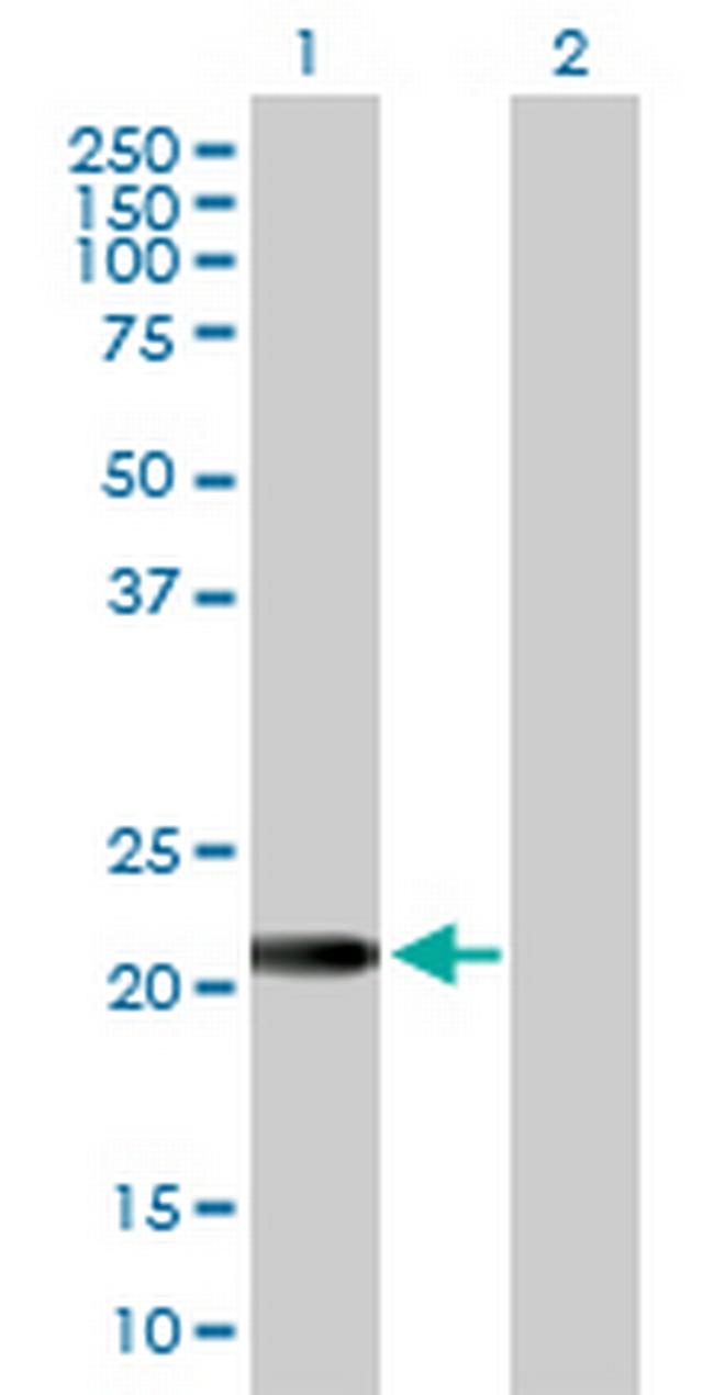 EFCAB2 Antibody in Western Blot (WB)