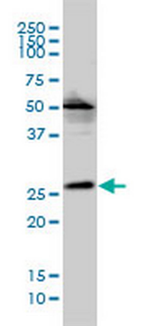 MGC10540 Antibody in Western Blot (WB)