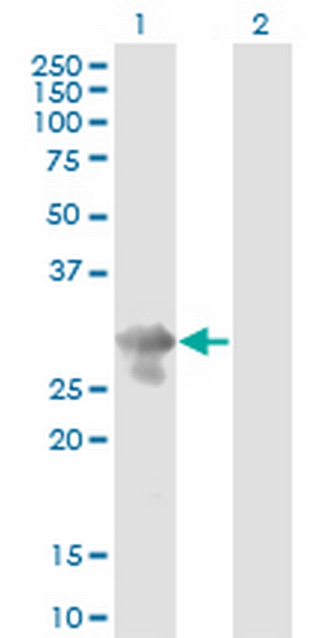 PCGF5 Antibody in Western Blot (WB)