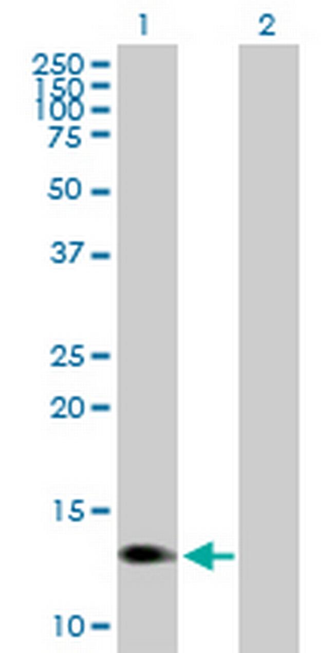 PROK1 Antibody in Western Blot (WB)