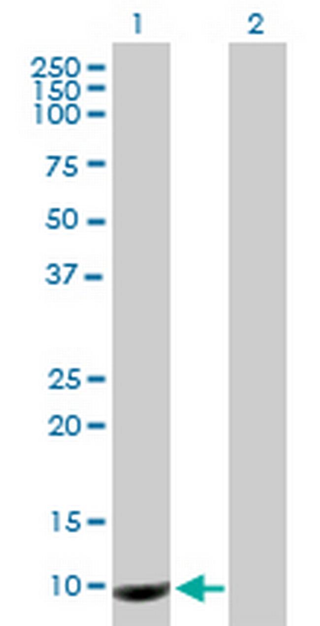 PROK1 Antibody in Western Blot (WB)