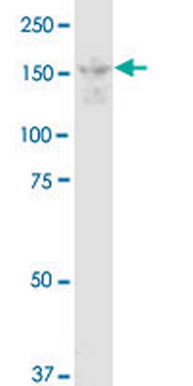 DOT1L Antibody in Western Blot (WB)