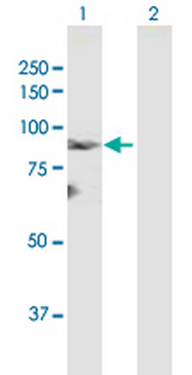 LZTS2 Antibody in Western Blot (WB)