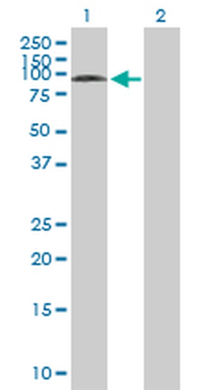 SYVN1 Antibody in Western Blot (WB)