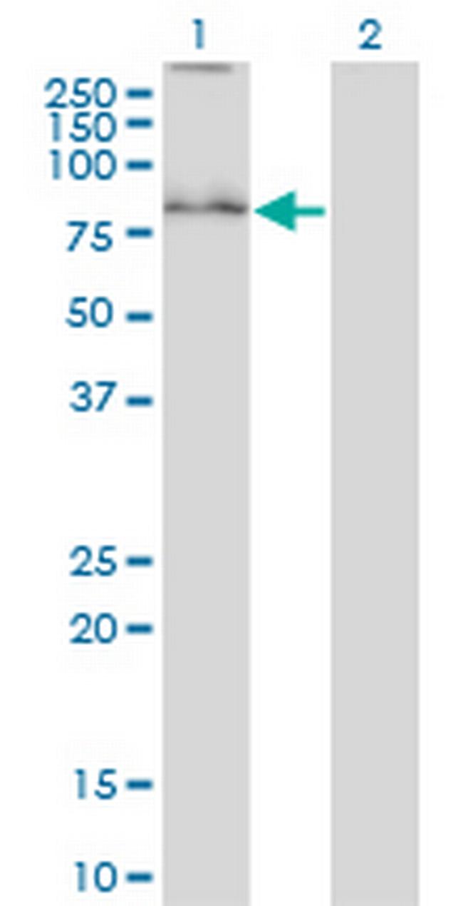 SYVN1 Antibody in Western Blot (WB)