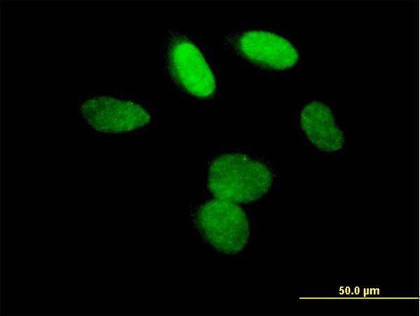 L3MBTL3 Antibody in Immunocytochemistry (ICC/IF)