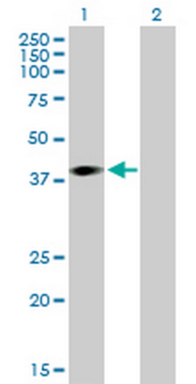 ARPM1 Antibody in Western Blot (WB)