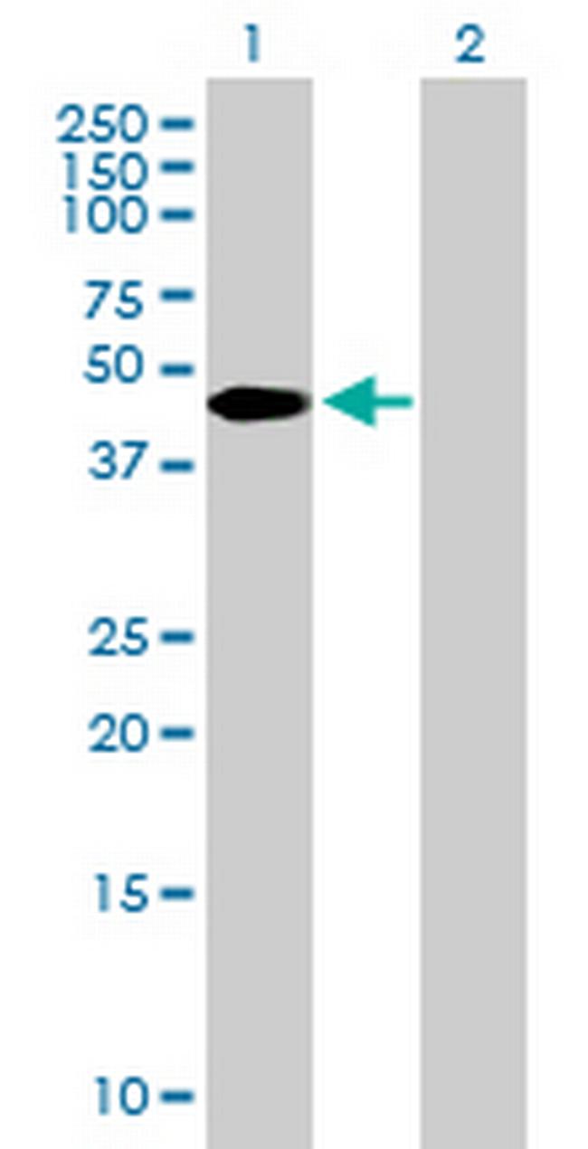 ZBTB37 Antibody in Western Blot (WB)