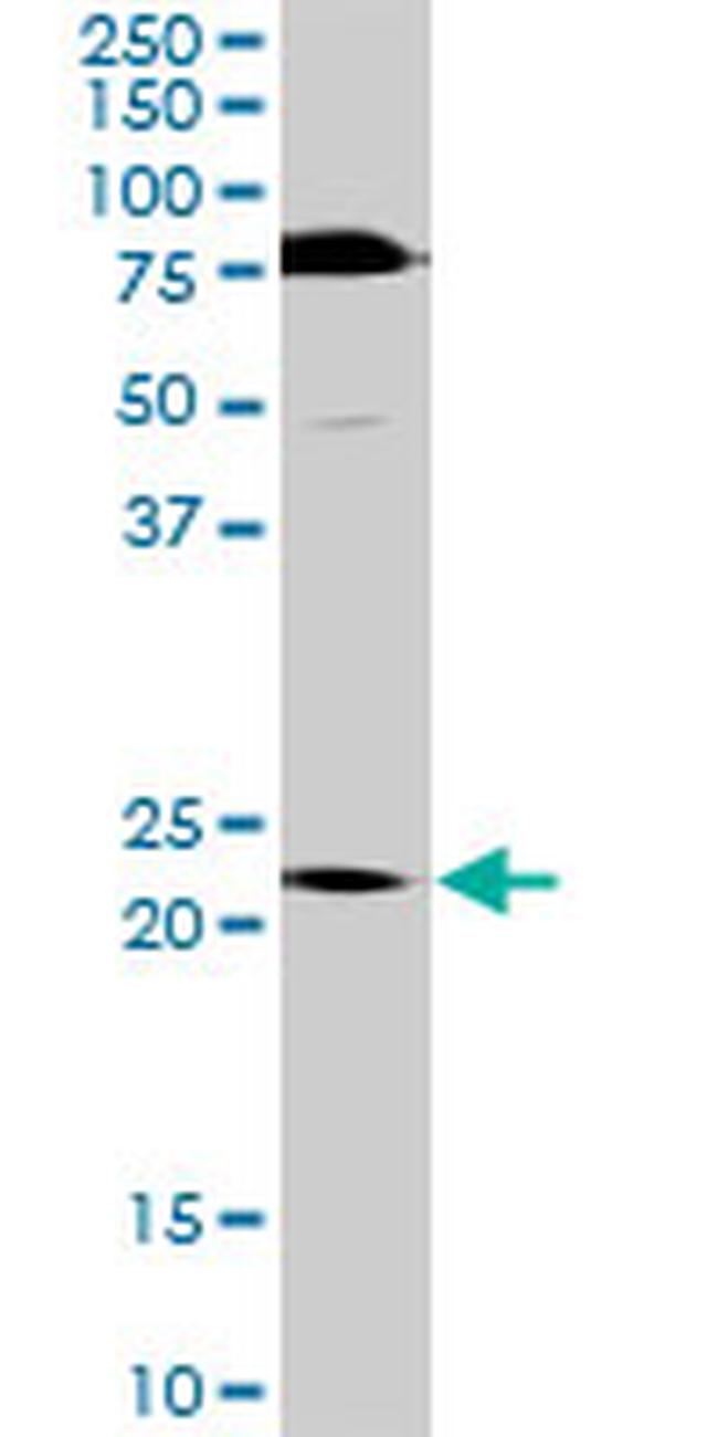 TRIM55 Antibody in Western Blot (WB)