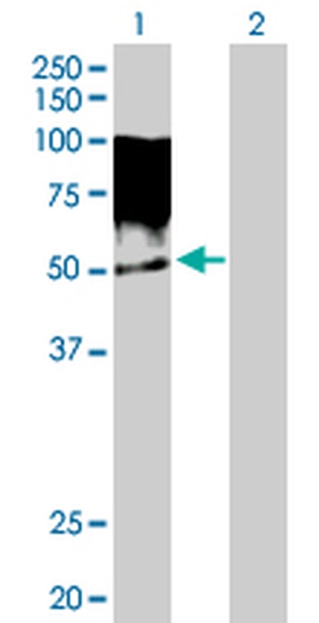 TRIM55 Antibody in Western Blot (WB)