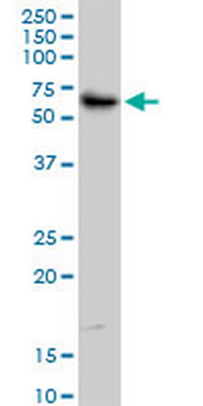 TRIM55 Antibody in Western Blot (WB)