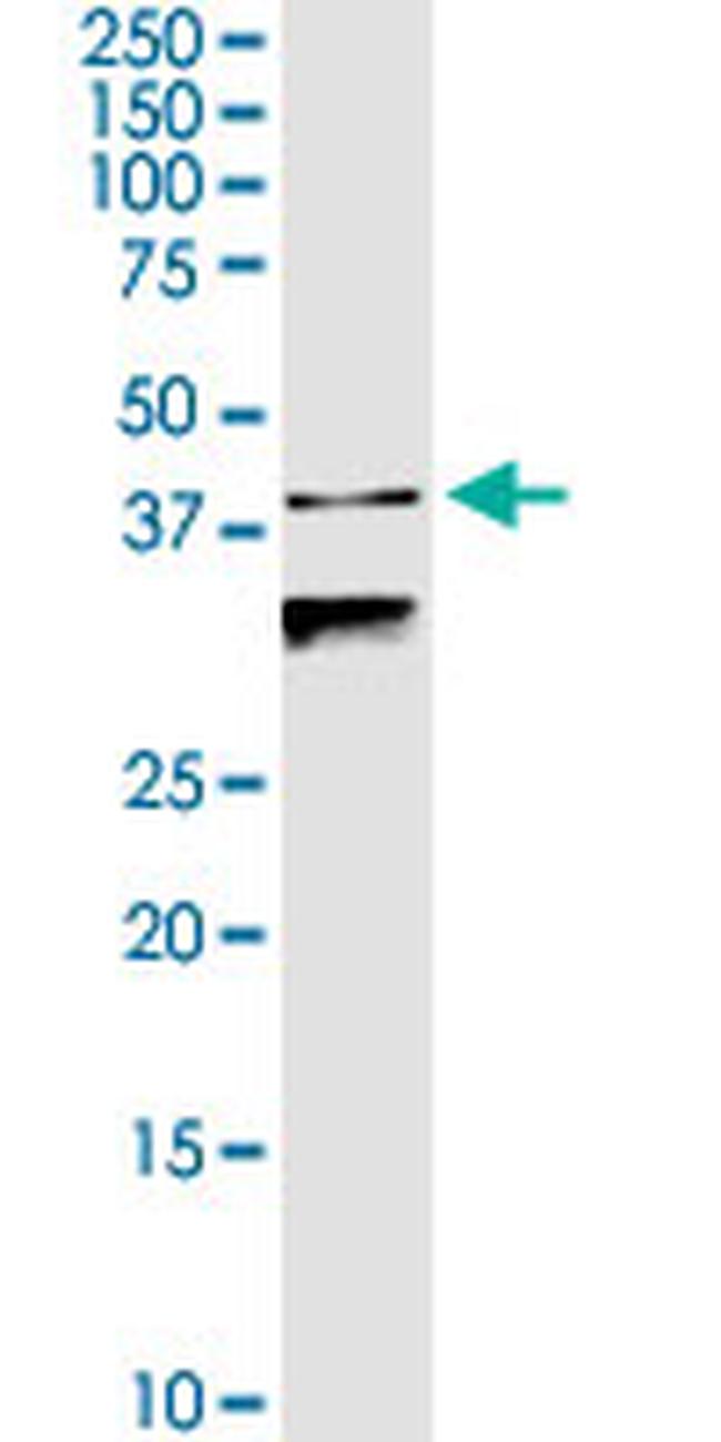 TRIM63 Antibody in Western Blot (WB)