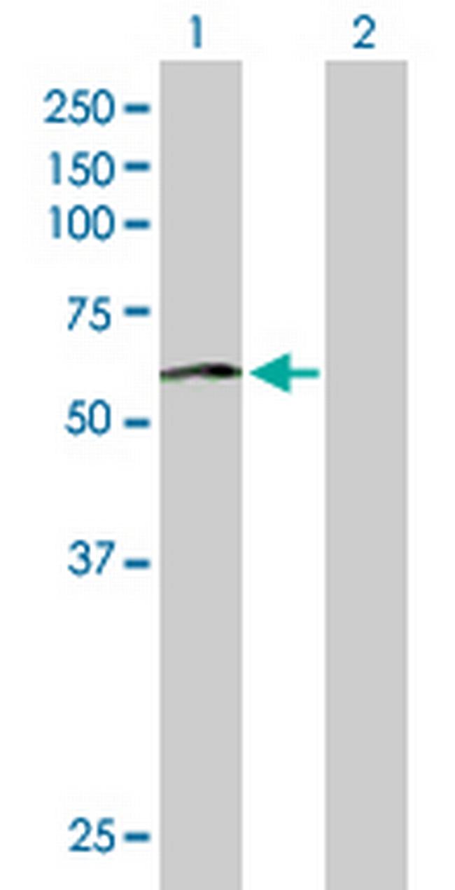 PHACS Antibody in Western Blot (WB)