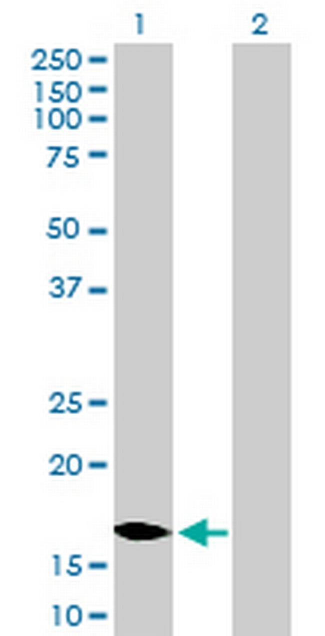 MCEE Antibody in Western Blot (WB)