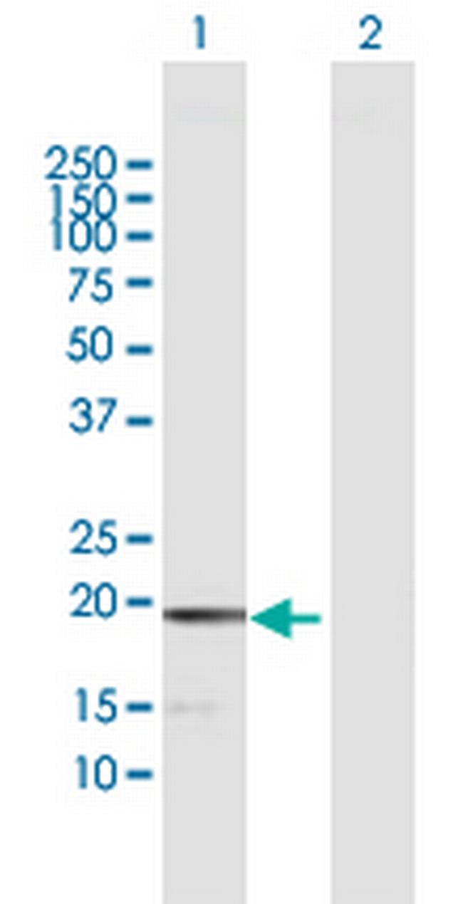 MCEE Antibody in Western Blot (WB)