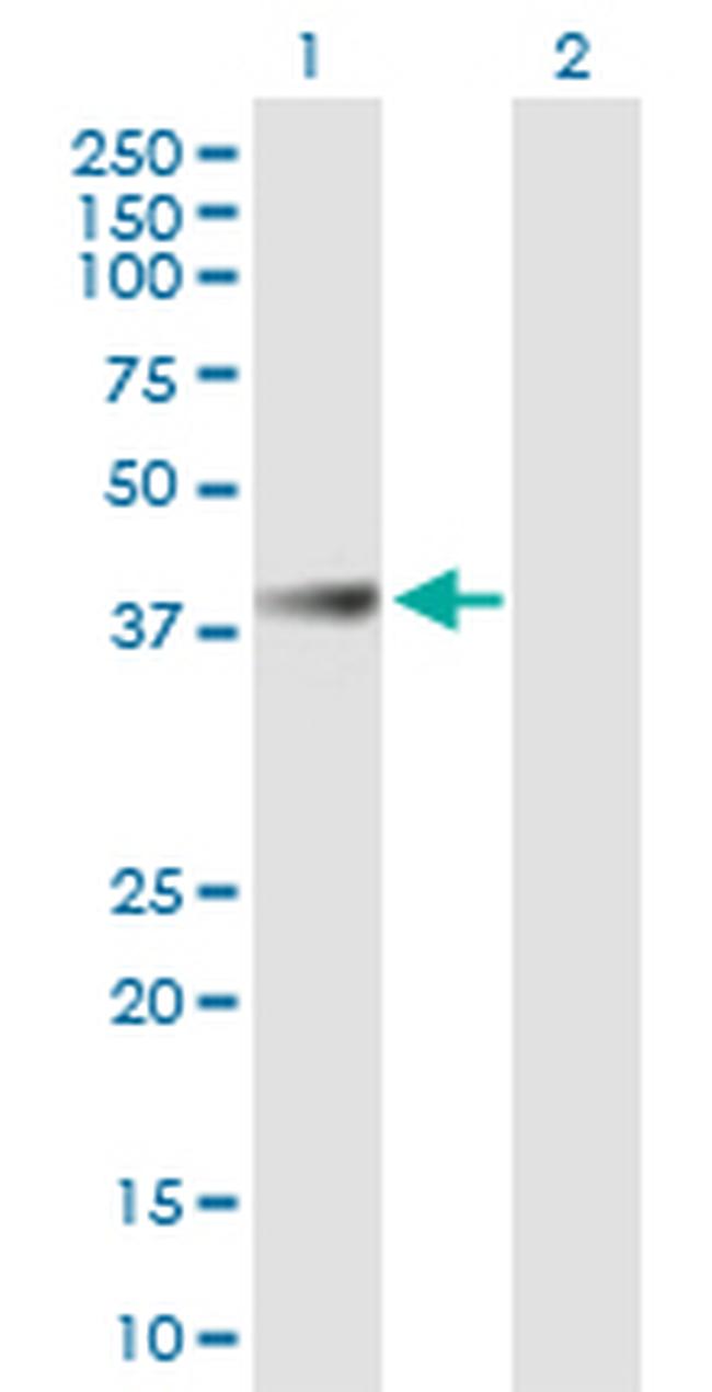 ABHD1 Antibody in Western Blot (WB)