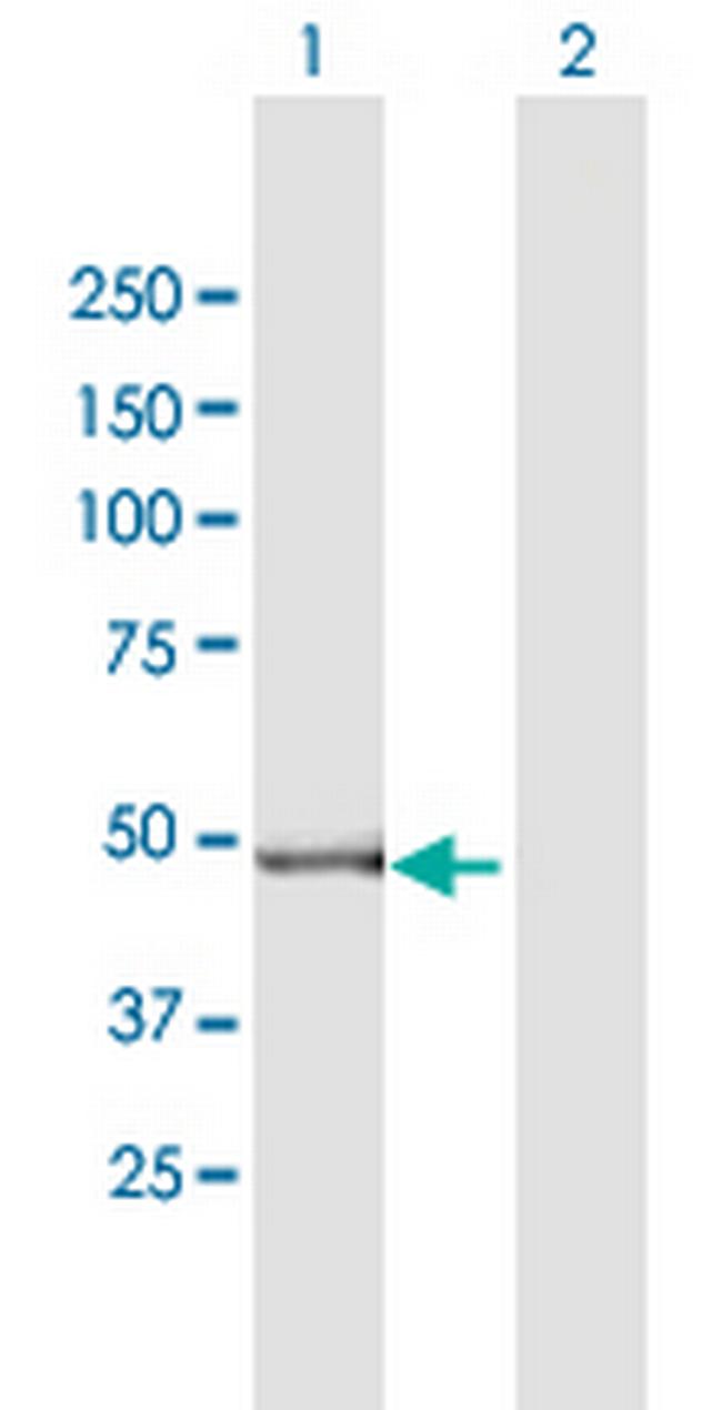 GPT2 Antibody in Western Blot (WB)