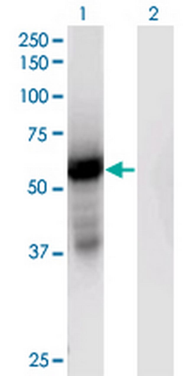 GPT2 Antibody in Western Blot (WB)