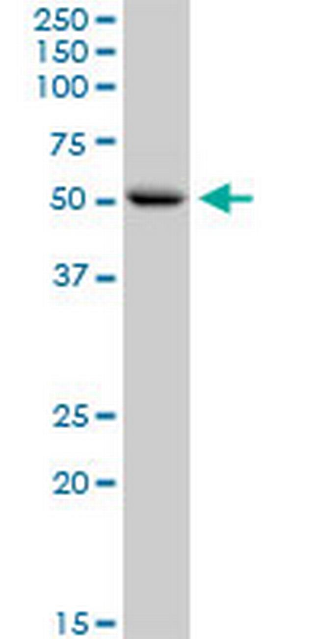 CNDP1 Antibody in Western Blot (WB)