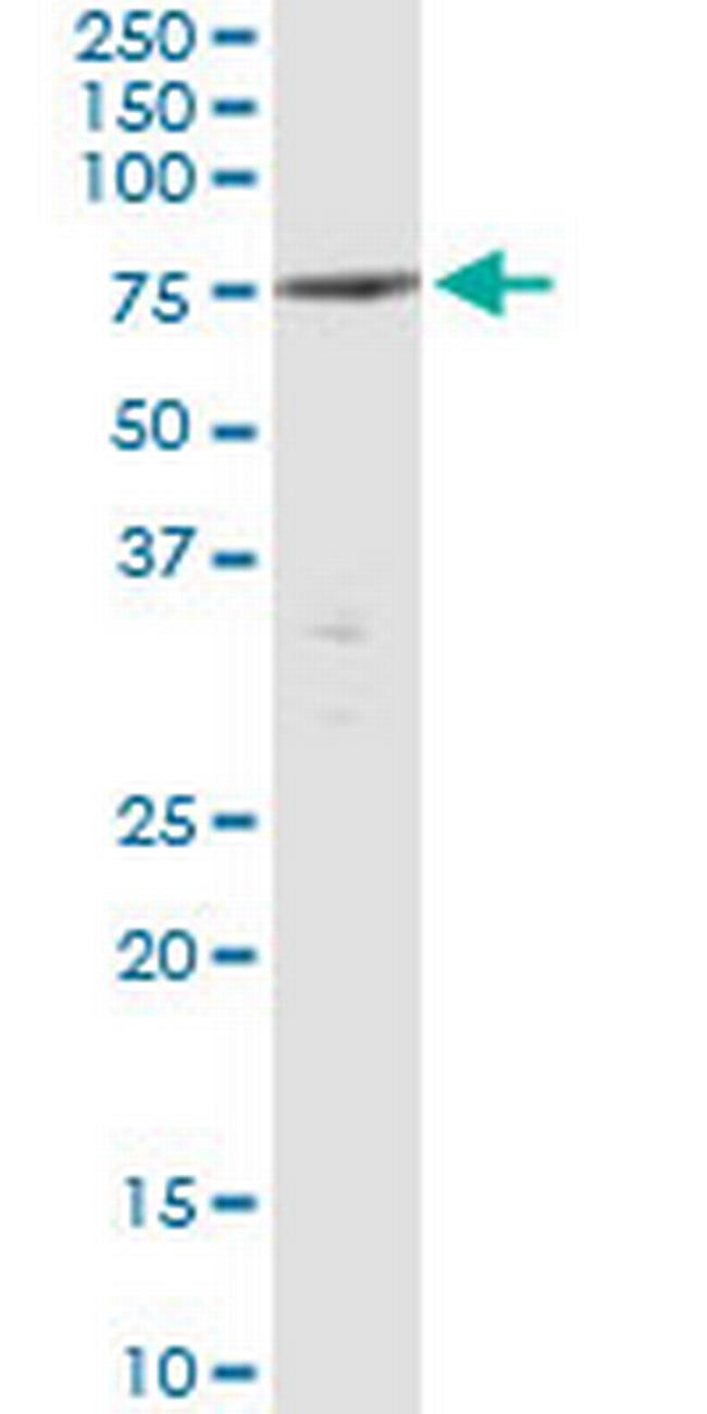 PTPN5 Antibody in Immunoprecipitation (IP)