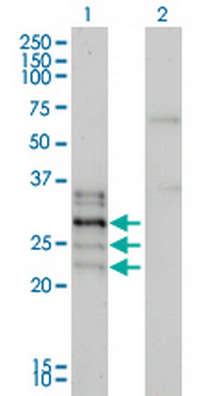 NFATC2IP Antibody in Western Blot (WB)