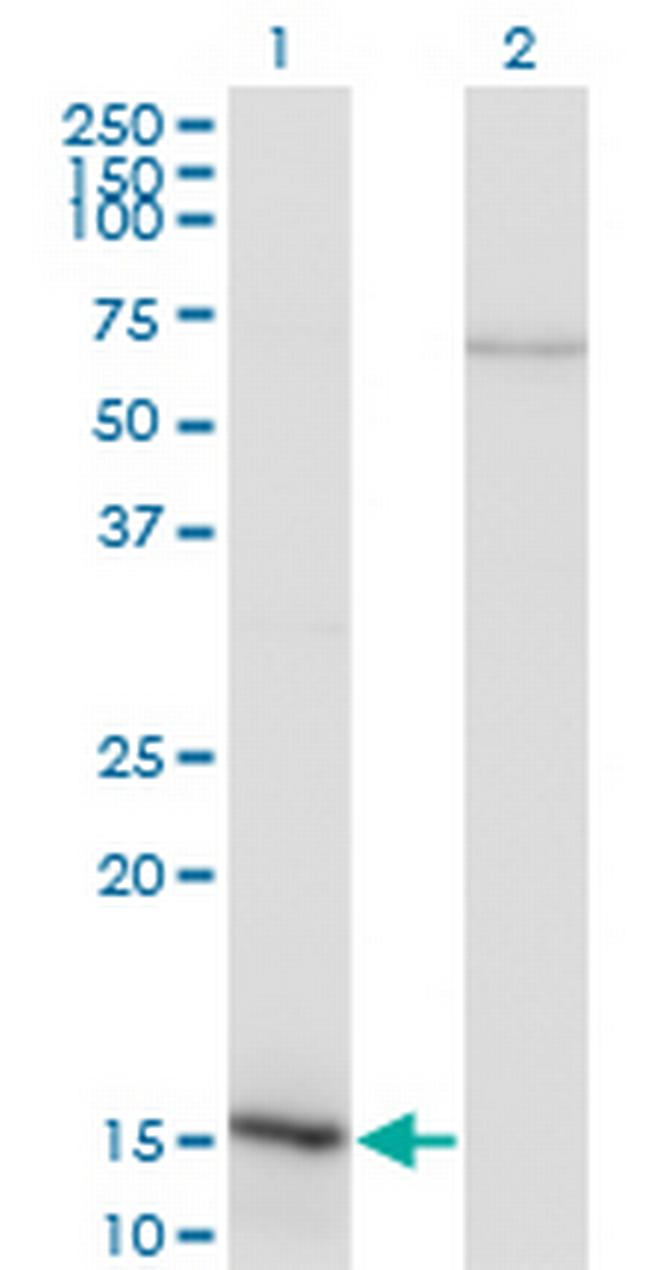 NFATC2IP Antibody in Western Blot (WB)