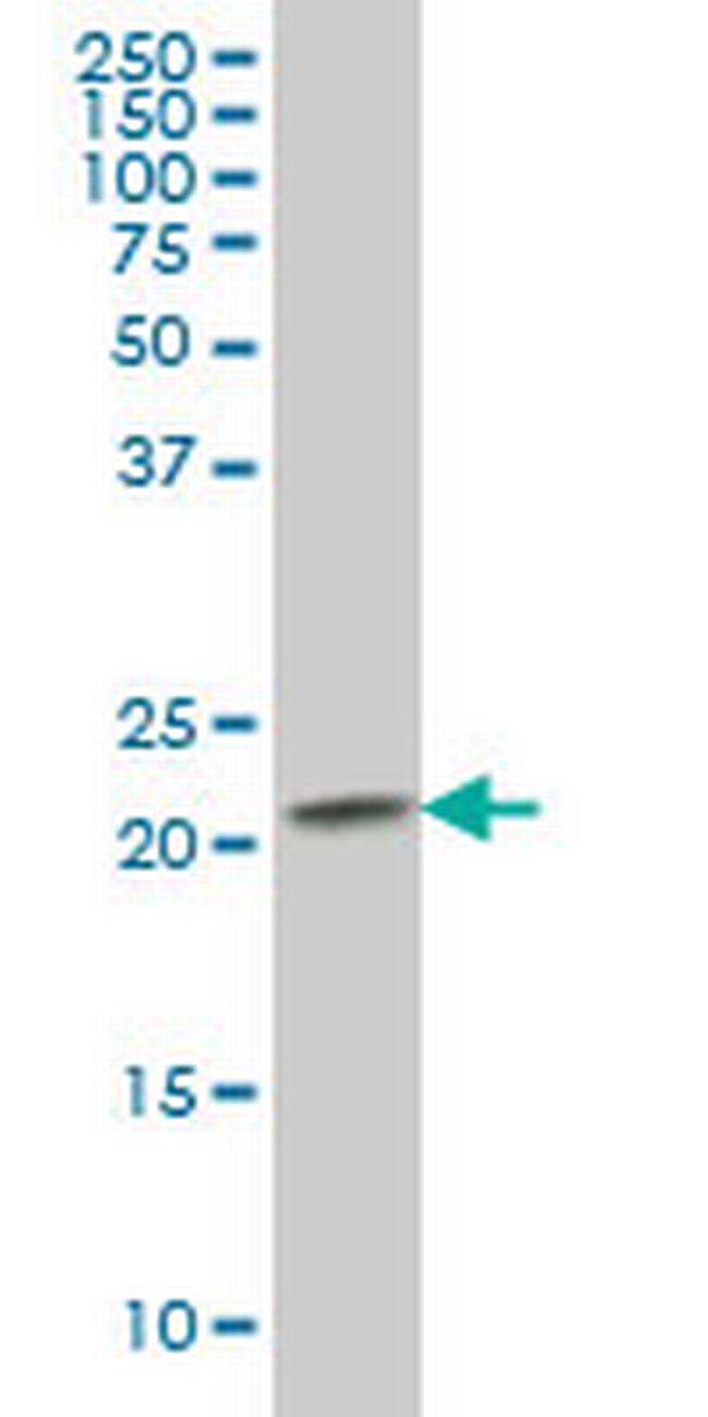 RAB2B Antibody in Western Blot (WB)