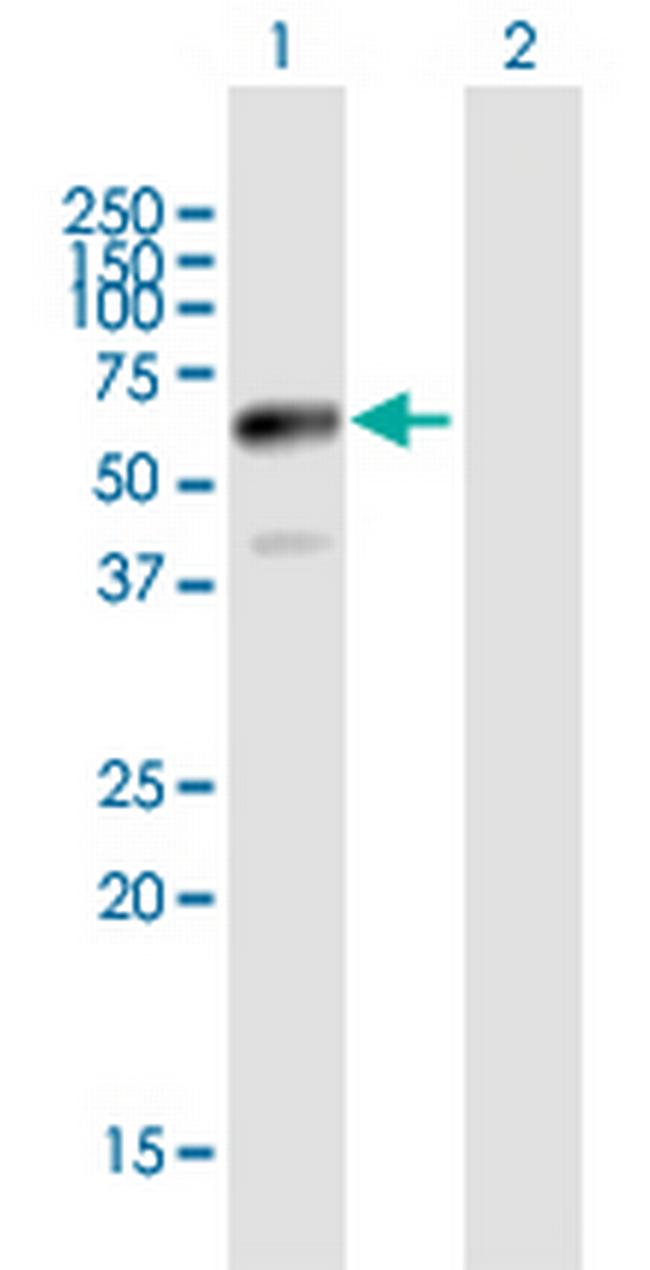 JUB Antibody in Western Blot (WB)