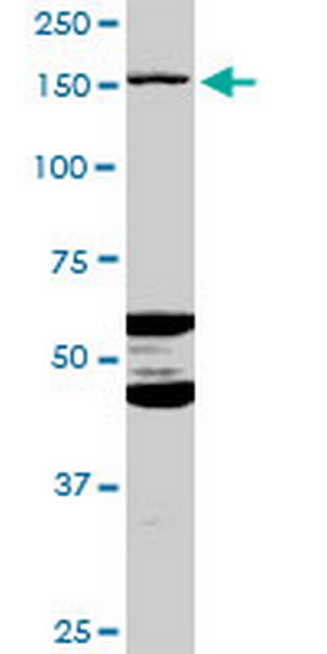 ABCC11 Antibody in Western Blot (WB)