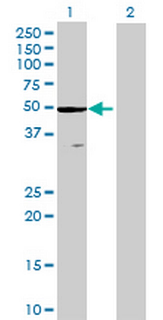 ZCCHC3 Antibody in Western Blot (WB)