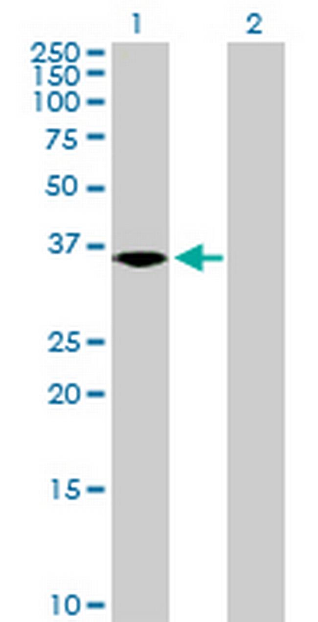 NKD2 Antibody in Western Blot (WB)