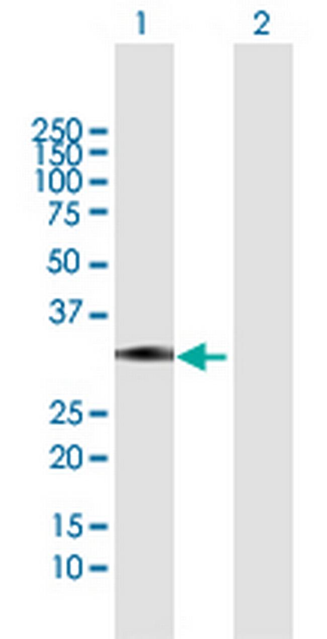 ZCRB1 Antibody in Western Blot (WB)