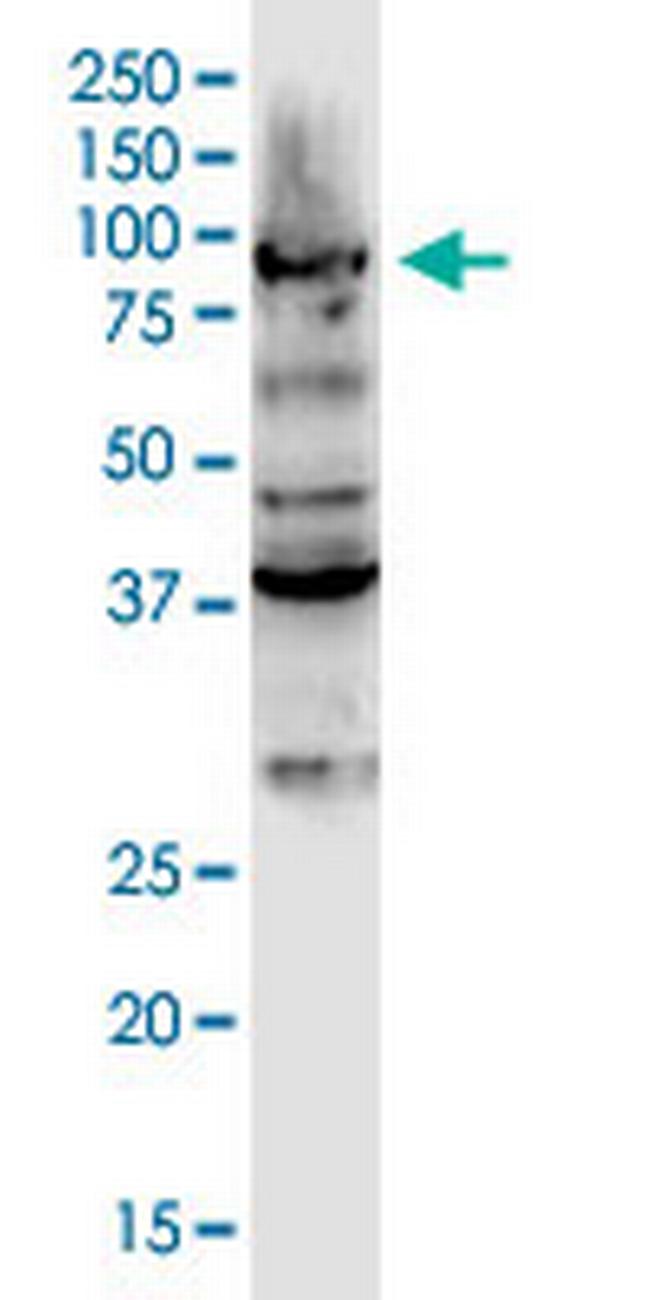 DCLK3 Antibody in Western Blot (WB)