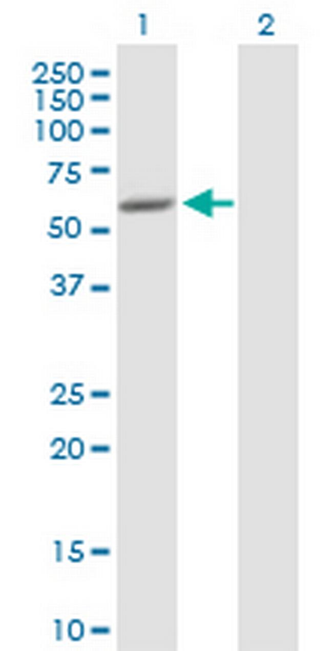 SCIN Antibody in Western Blot (WB)