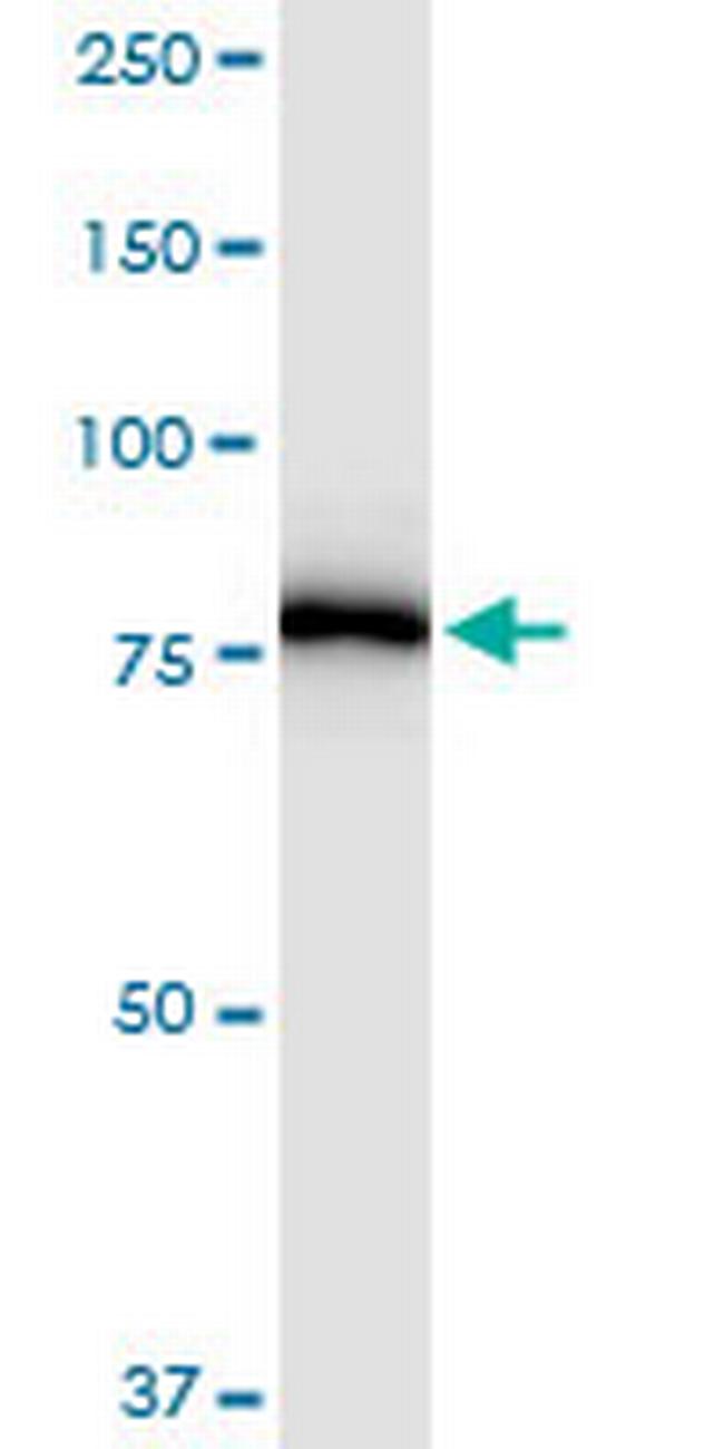 PNPT1 Antibody in Western Blot (WB)