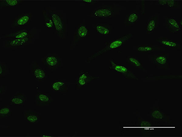 LHX4 Antibody in Immunocytochemistry (ICC/IF)