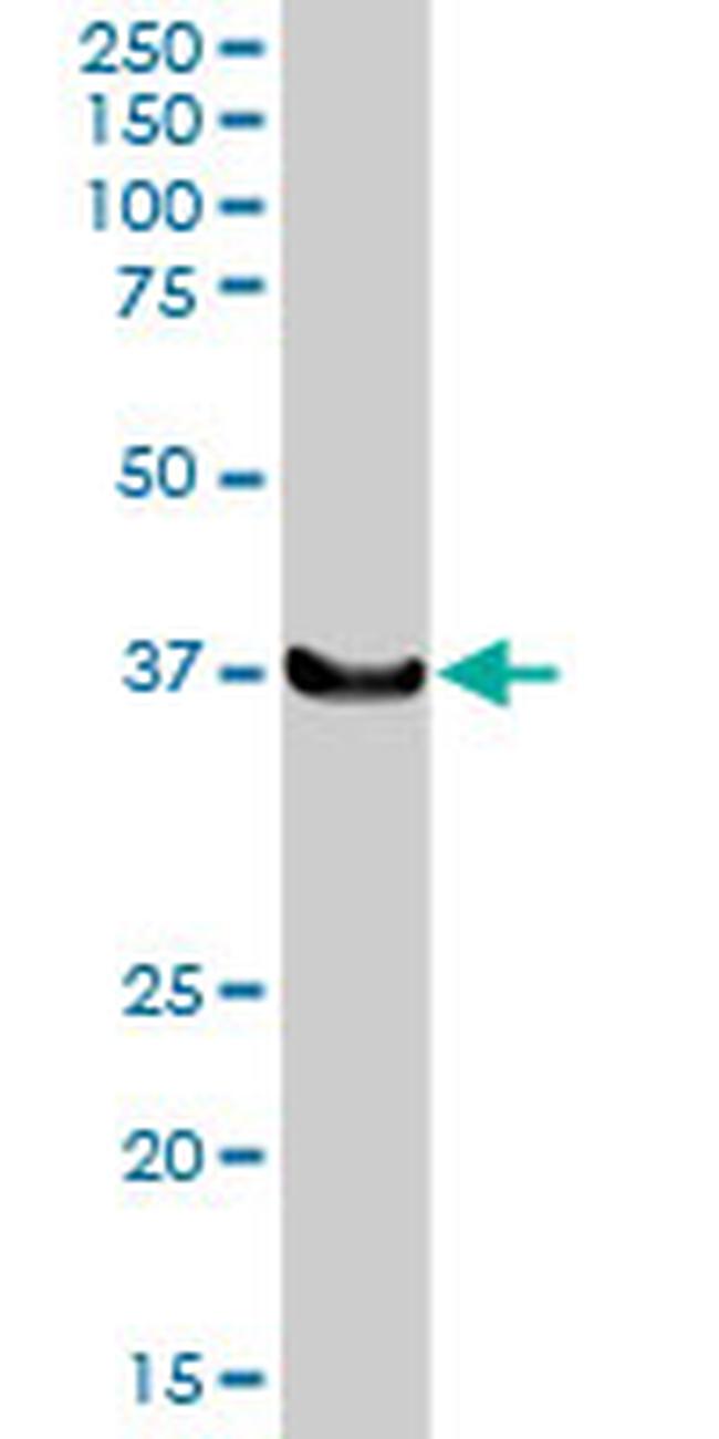 LHX4 Antibody in Western Blot (WB)